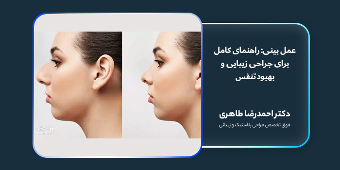 عمل بینی: راهنمای کامل برای جراحی زیبایی و بهبود تنفس
