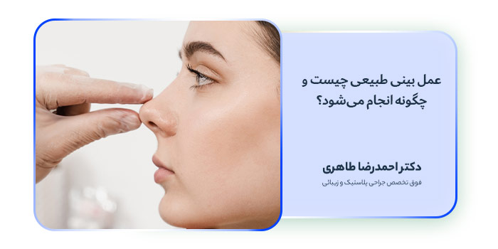 عمل بینی طبیعی چیست و چگونه انجام می‌شود؟