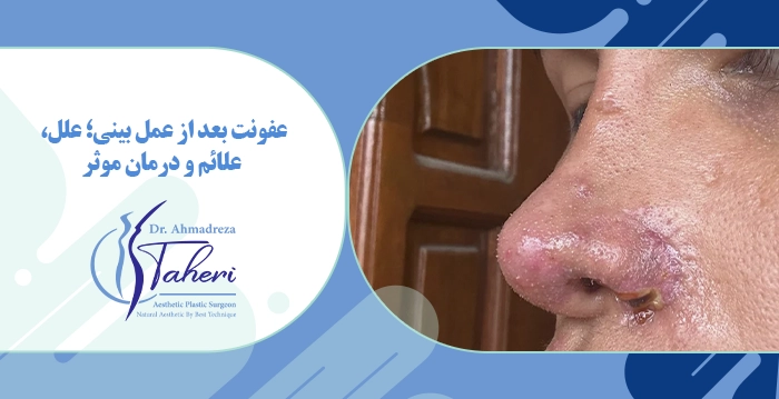 عفونت بعد از عمل بینی؛ علل، علائم و درمان موثر