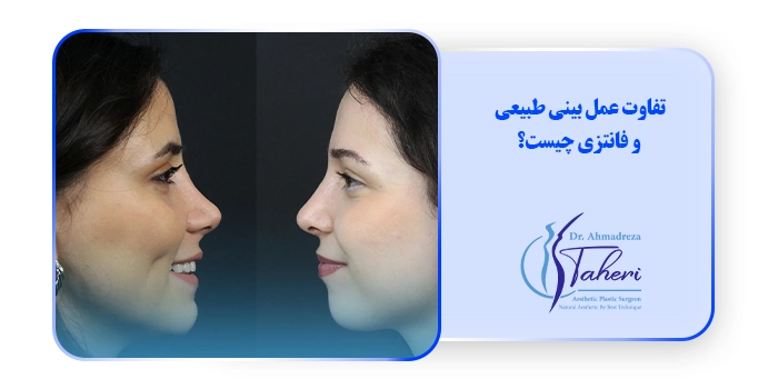 تفاوت عمل بینی طبیعی و فانتزی چیست؟
