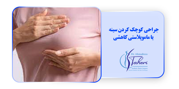 ماموپلاستی کاهشی: جراحی کوچک کردن سینه