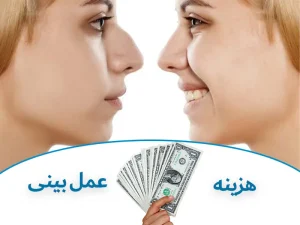 هزینه عمل بینی